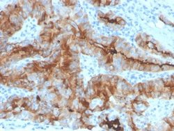 Thyroglobulin Antibody (rTGB/4744) - Azide and BSA Free, Novus Biologicals 100 &mu;g | Buy Online | Novus Biologicals | Fisher Scientific
